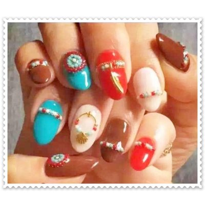 画像5: キャンディーパーツ　ケース入り